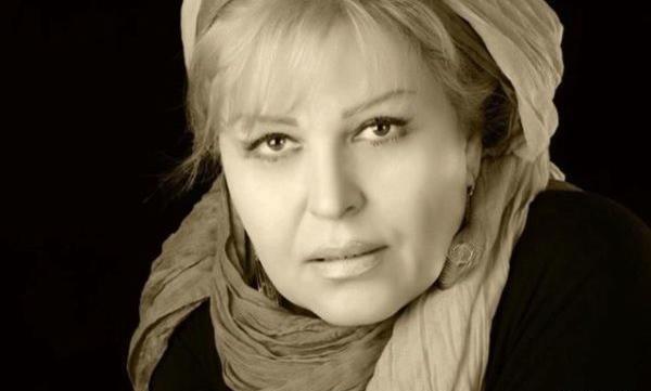عکس اکرم محمدی بعد از عمل زیبایی