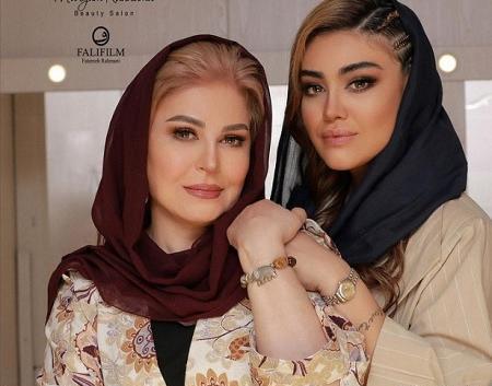عکس اکرم محمدی بعد از عمل زیبایی