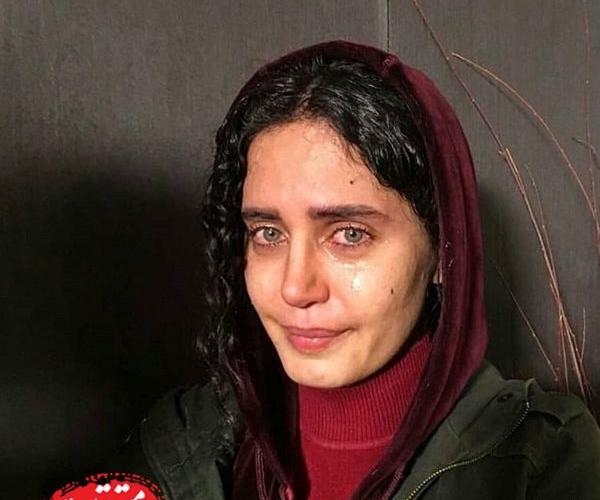 عکس الناز شاکردوست قبل از عمل