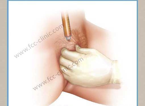 عکس های واقعی عمل لابیاپلاستی