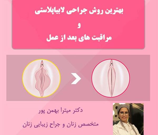 عکس های واقعی عمل لابیاپلاستی
