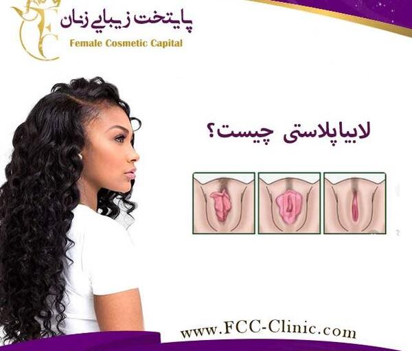 عکس های واقعی عمل لابیاپلاستی