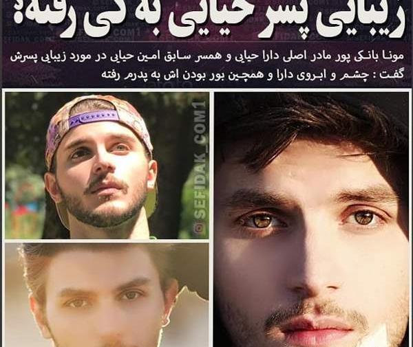 عکس امین حیایی قبل از عمل زیبایی