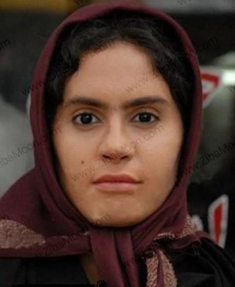 عکس امین حیایی قبل از عمل زیبایی