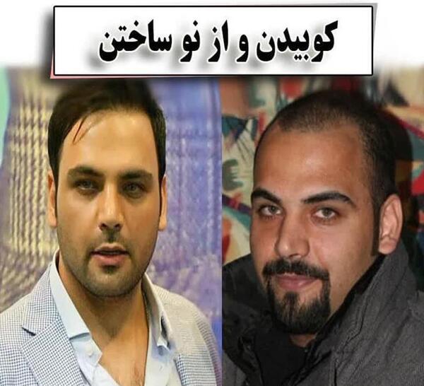 عکس امین حیایی قبل از عمل زیبایی
