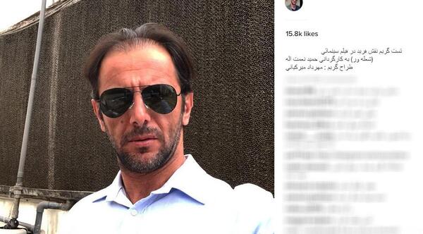 عکس امین حیایی قبل از عمل زیبایی