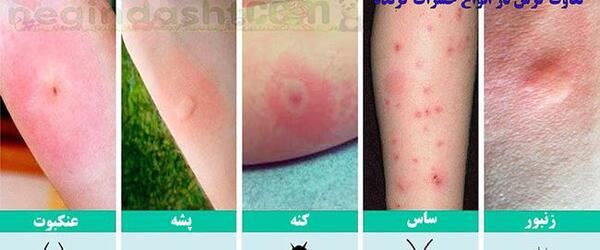 عکس نیش سوسک