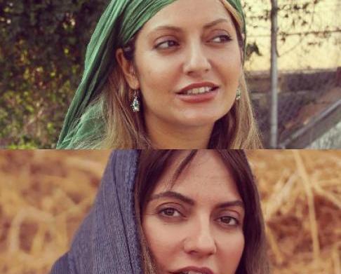 عکس بهاره افشاری قبل عمل بینی