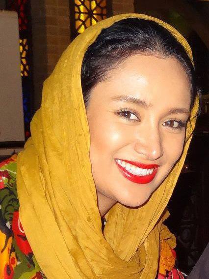 عکس بهاره افشاری قبل عمل بینی