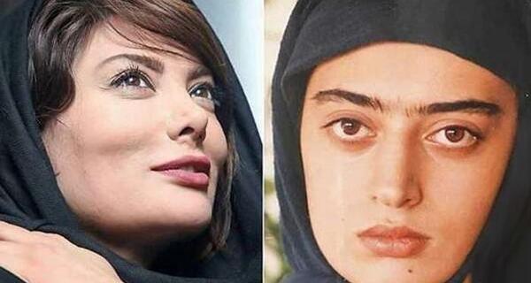 عکس حدیثه تهرانی بعد از عمل