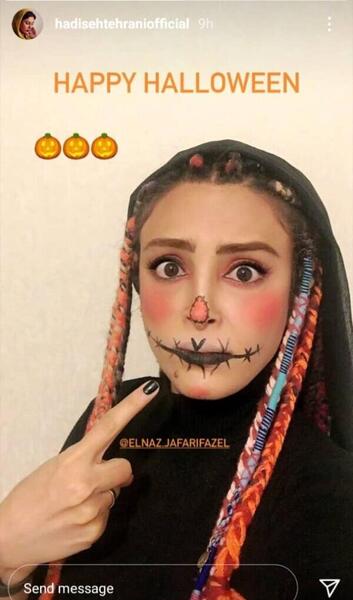 عکس حدیثه تهرانی بعد از عمل