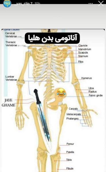عکس های خنده دار هلیا قمه کش
