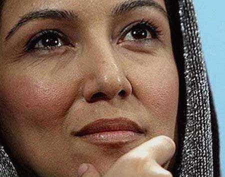 عکس قبل از عمل پانته آ بهرام