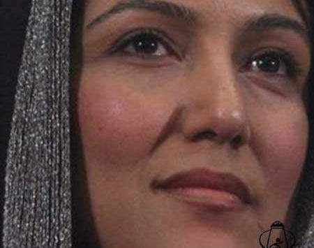 عکس قبل از عمل پانته آ بهرام