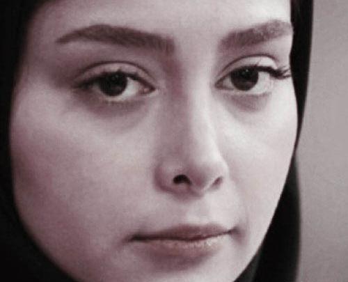 عکس قبل عمل دیبا زاهدی