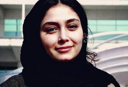 عکس قبل عمل دیبا زاهدی