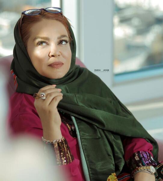 عکس بهاره رهنما بعد از عمل زیبایی