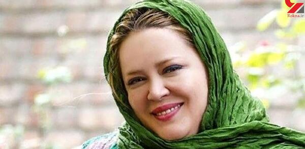 عکس بهاره رهنما بعد از عمل زیبایی