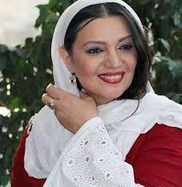 عکس الهام پاوه نژاد قبل از عمل بینی