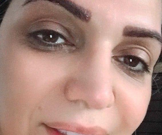 عکس الهام پاوه نژاد قبل از عمل بینی