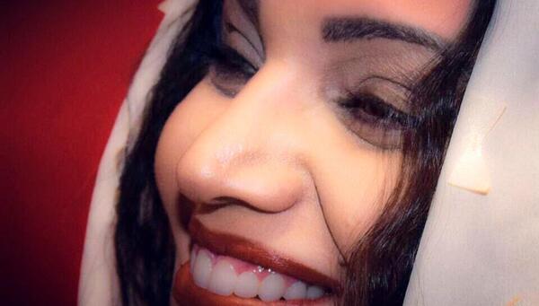 عکس الهام پاوه نژاد قبل از عمل بینی
