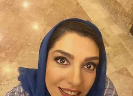 عکس الیکا عبدالرزاقی بعد از عمل بینی