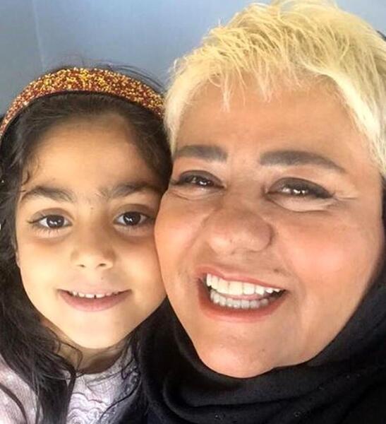 عکس کچل رابعه اسکویی