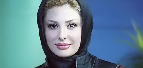 عکس بهاره رهنما قبل از عمل بینی