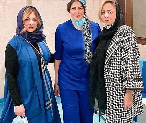 عکس بهاره رهنما قبل از عمل بینی