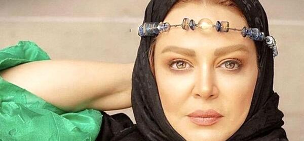 عکس بهاره رهنما قبل از عمل بینی
