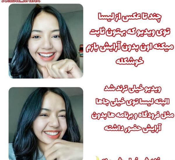 عکس جیسو بلک پینک قبل از عمل