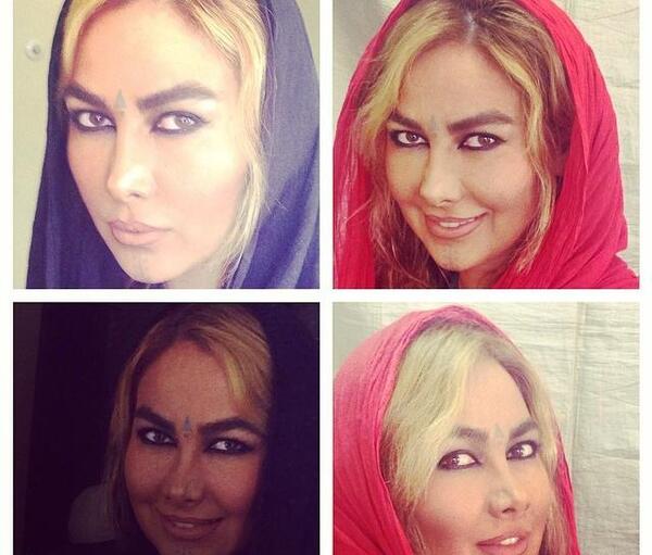 عکس آنا نعمتی قبل و بعد عمل
