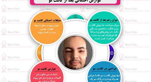 عکس عوارض کاشت مو