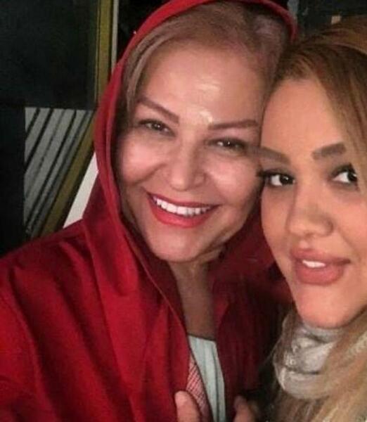 عکس اکرم محمدی قبل از عمل
