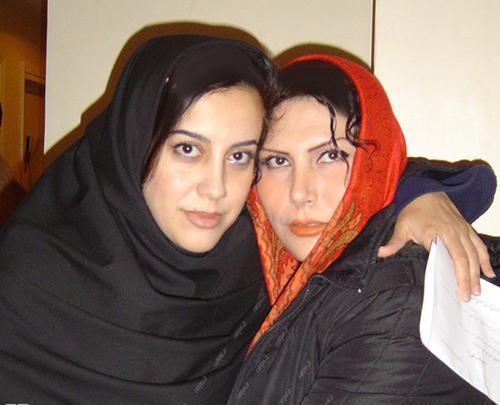عکسهای آشا محرابی قبل از عمل