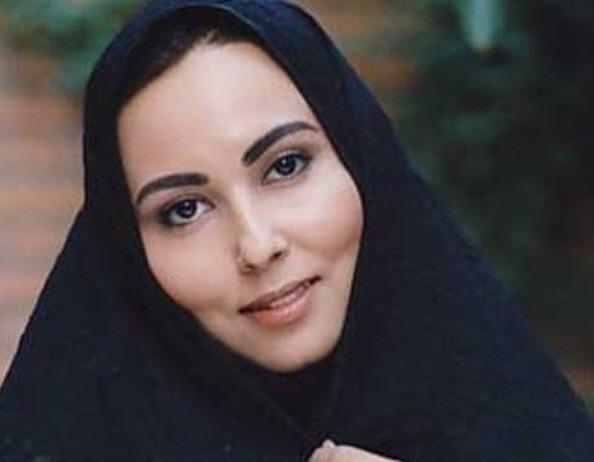 عکس پرستو صالحی بعد از کاشت ابرو