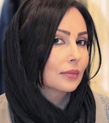 عکس پرستو صالحی بعد از کاشت ابرو