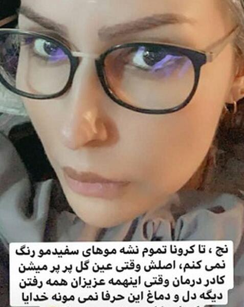 عکس پرستو صالحی بعد از کاشت ابرو