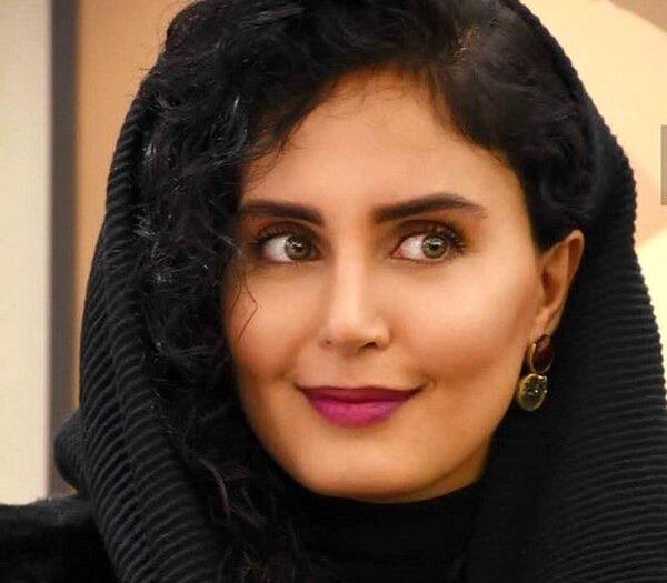 عکس صورت الناز شاکردوست