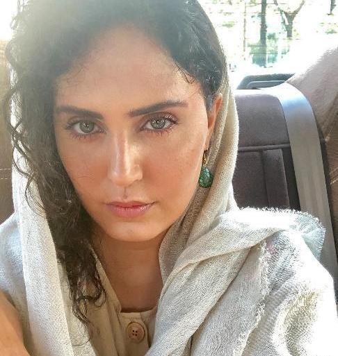 عکس صورت الناز شاکردوست