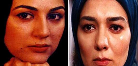 عکس پوپک گلدره تصادف