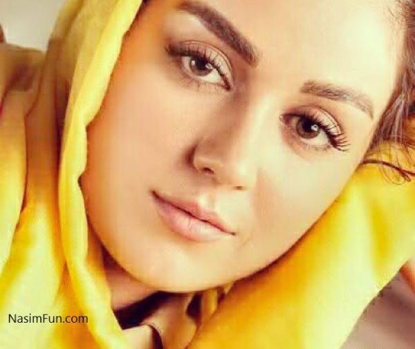 عکس افسانه پاکرو قبل از عمل زیبایی