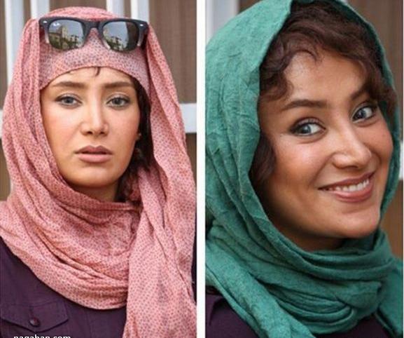 عکس بهاره افشاری قبل و بعد از عمل