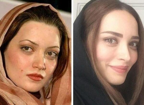عکس بهنوش طباطبایی بعد از عمل