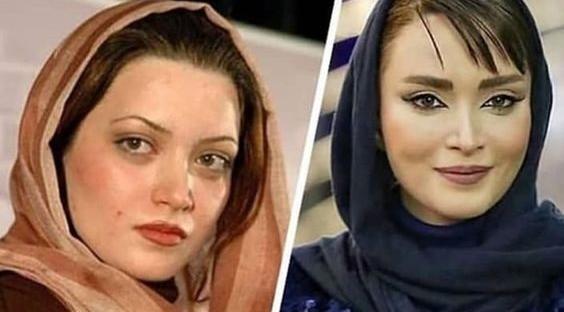 عکس بهنوش طباطبایی بعد از عمل