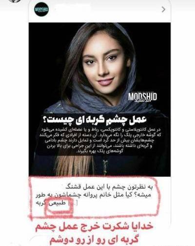 عکس ترلان پروانه قبل از عمل دماغ