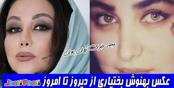 عکس بهنوش بختیاری قبل از عمل دماغ