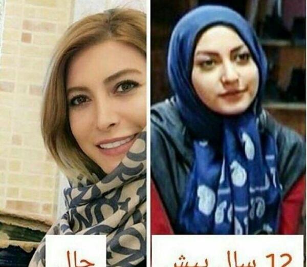 عکس تصاویر پژمان بازغی قبل از عمل بینی