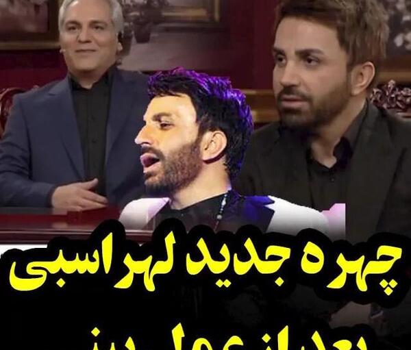 عکس تصاویر پژمان بازغی قبل از عمل بینی