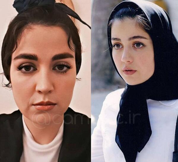 عکس تصاویر افسانه پاکرو قبل از عمل